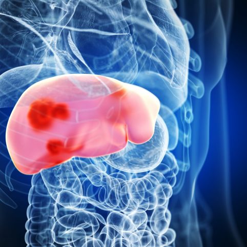 Picture of the liver